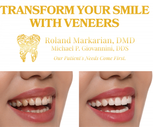 Transform Your Smile with Veneers