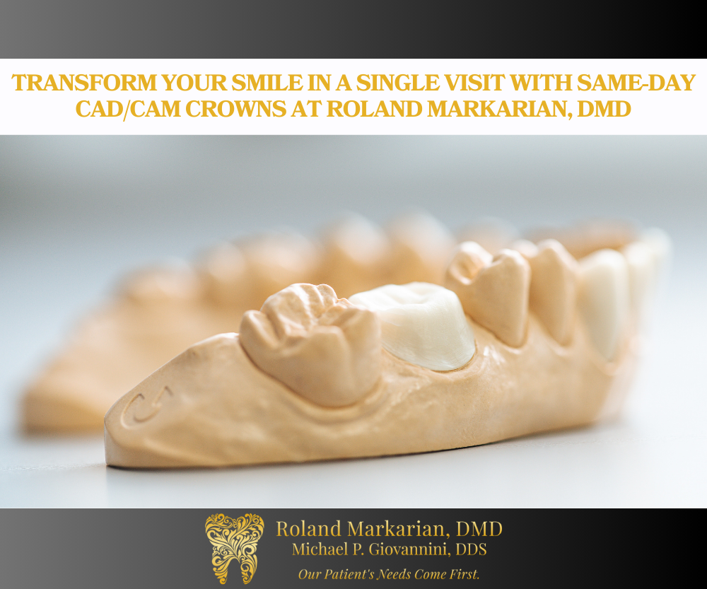 Transform Your Smile in a Single Visit with Same-Day CAD/CAM Crowns at ...